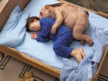 Patricia Piccinini – Undivided-2005