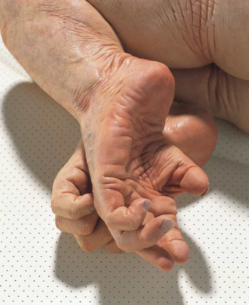 Family, Patricia Piccinini detail2