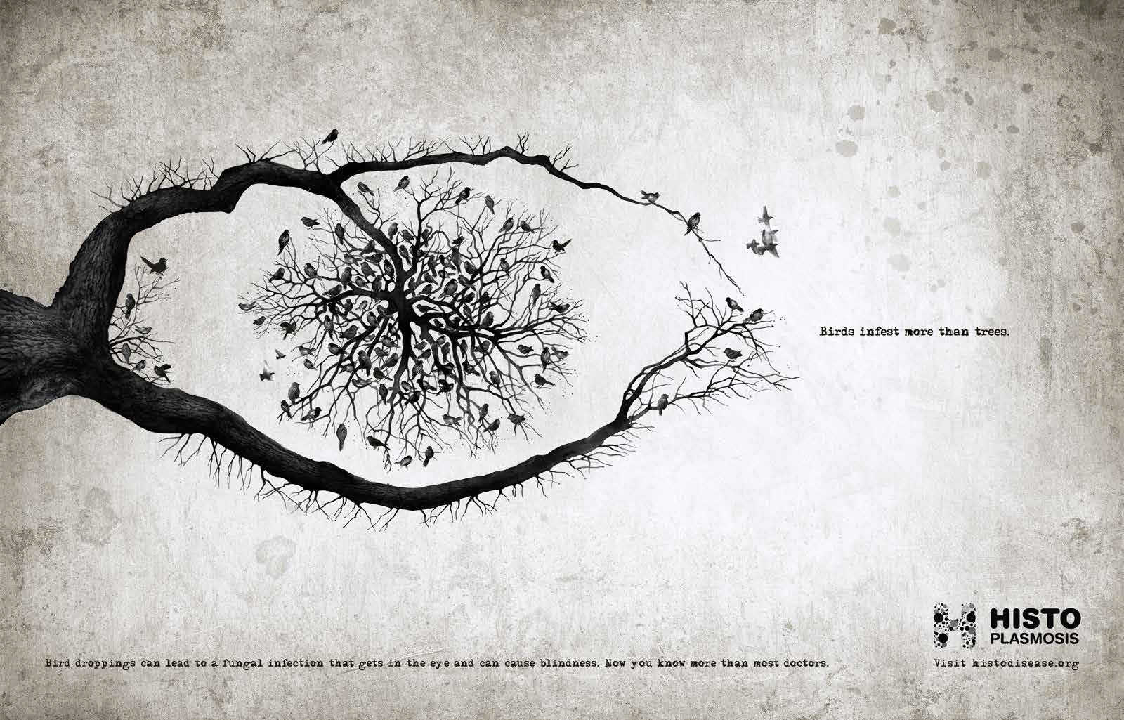 Histoplasmosis-Eye