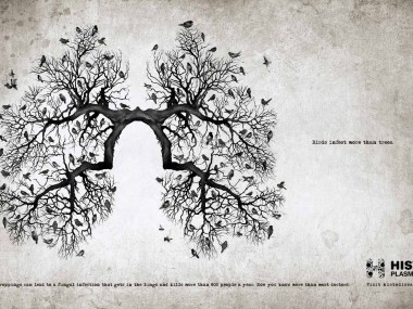 Histoplasmosis-Lungs