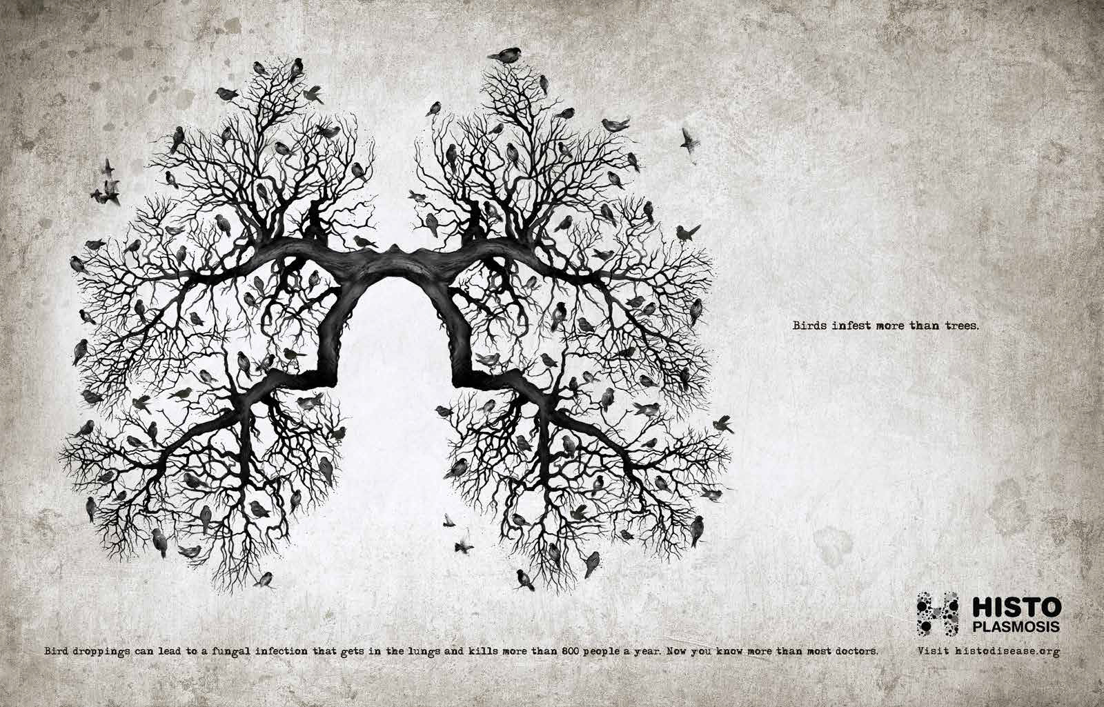 Histoplasmosis-Lungs