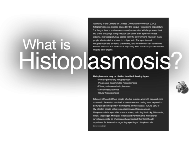 WHAT_IS_HISTOplasmosis